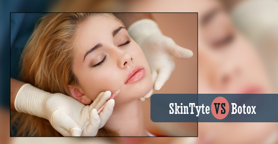 SkinTyte VS Botox SkinTyte VS Botox